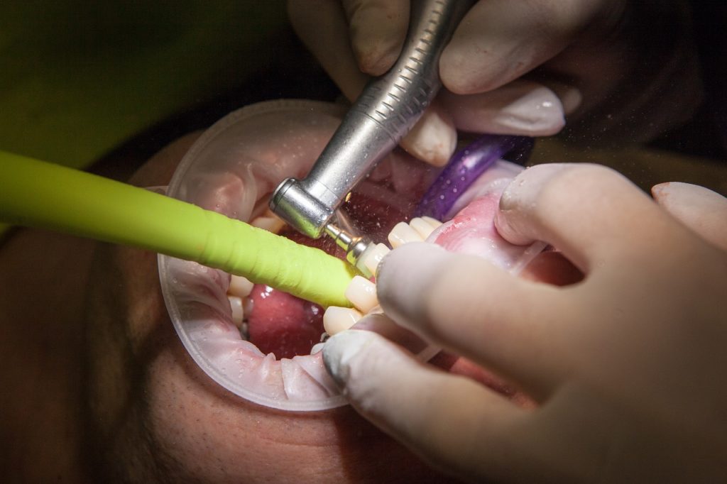 Leczenie periodontologiczne