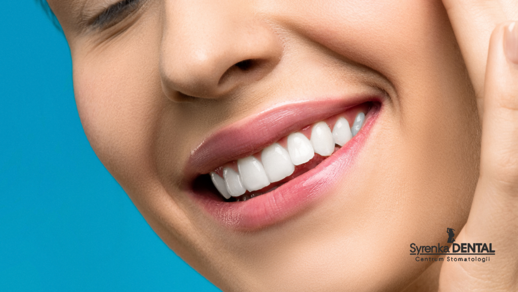 Zbliżenie promiennego, nieskazitelnego uśmiechu, stanowiące przykład pomyślnych wyników stosowania kompleksowych etapów leczenia ortodontycznego Syrenka Dental na Ursynowie.