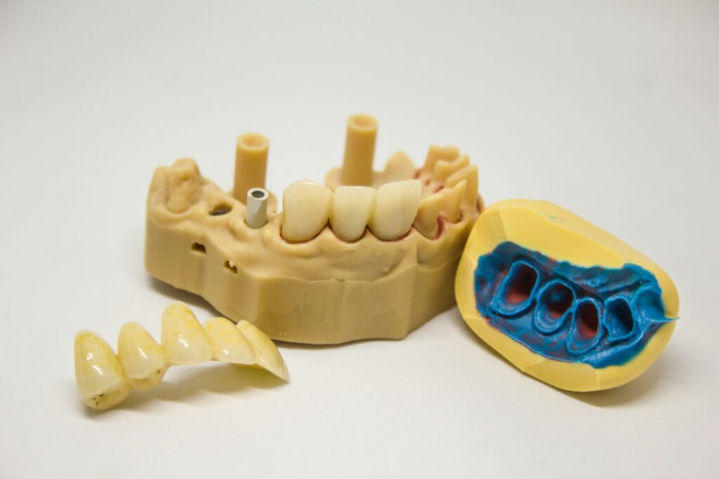 Estetyczne korony cyrkonowe dostępne w Syrenka Dental na Ursynowie - idealne rozwiązanie dla wymagających pacjentów.